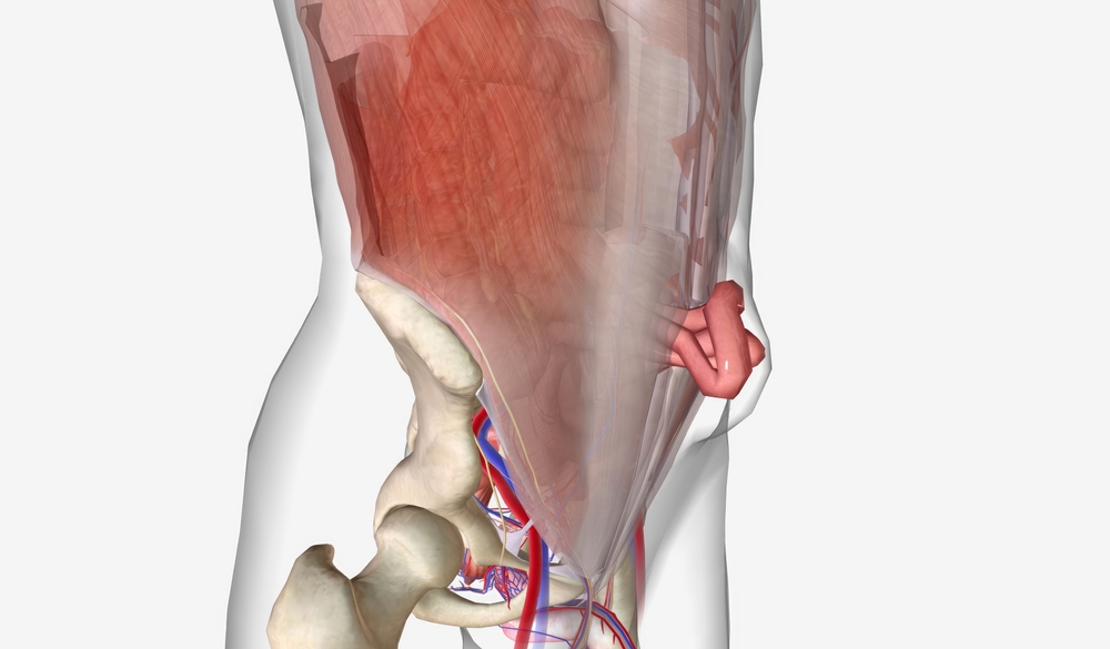 imagem de uma hérnia ventral