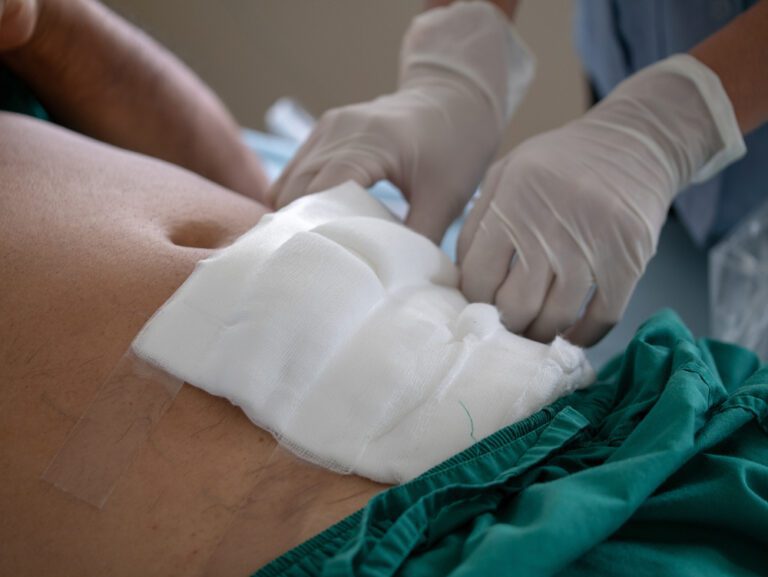 imagem ilustrativa de uma cirurgia de hernia inguinal