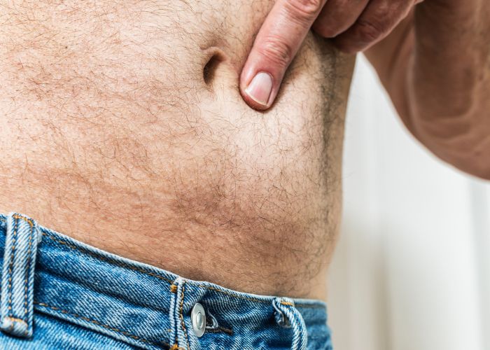 Pessoa apontando para a região do umbigo, possivelmente indicando dor ou desconforto na área abdominal, sugerindo preocupação com hérnia ou outra condição.