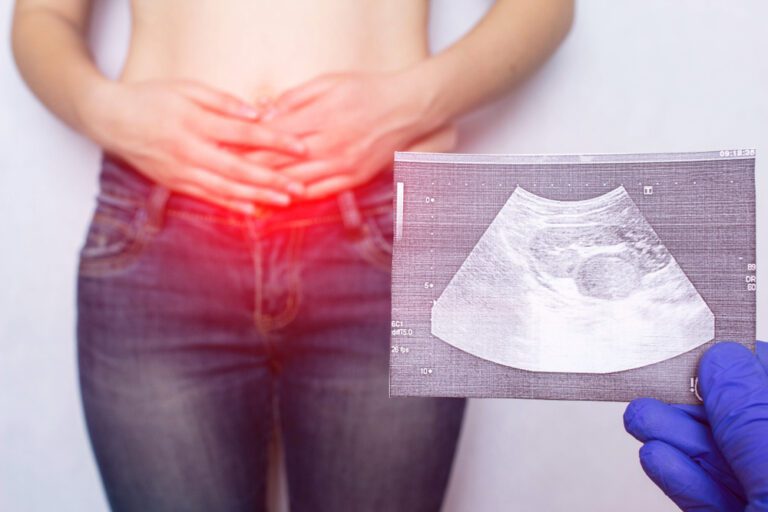 Médico segura o resultado de um exame de hérnia inguinal