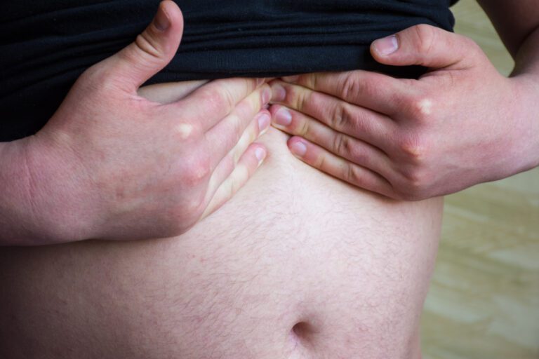 Homem pressiona a barriga na parte superior - hérnia hiatal por deslizamento