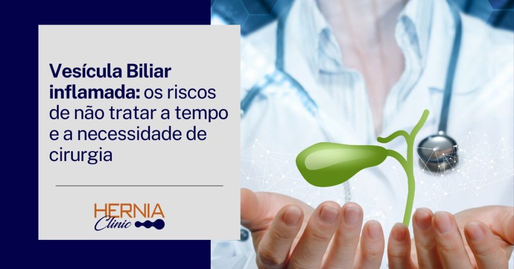 Imagem de um médico segurando uma representação gráfica de uma vesícula biliar, com texto que destaca a importância de tratar a inflamação a tempo para evitar cirurgia.