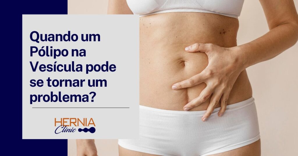 Texto "Quando um pólipo na vesícula pode se tornar um problema?" ao lado de uma mulher segurando o abdômen, destacando a questão de saúde.