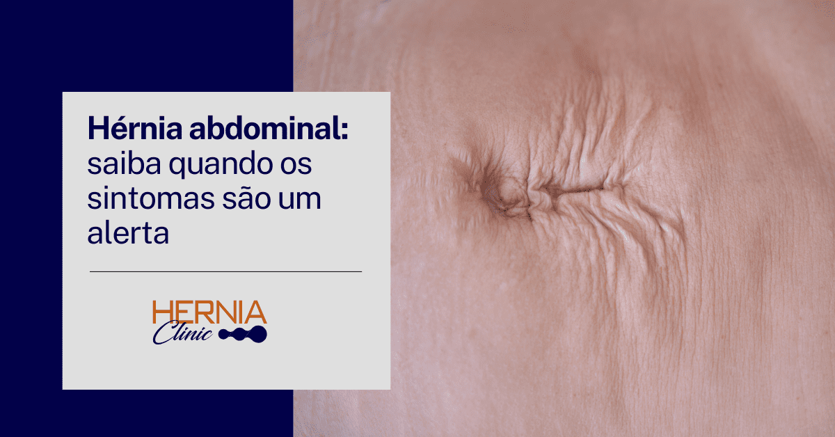 Hérnia abdominal: saiba quando os sintomas são um alerta - Centro de ...