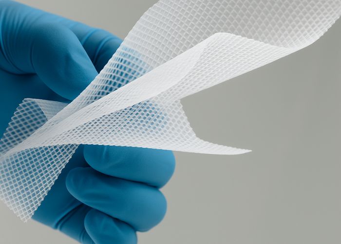 Mão com luva azul segurando uma tela cirúrgica de malha branca, usada em procedimentos para correção de hérnias.