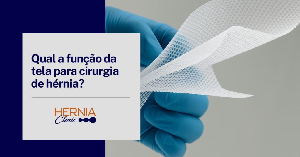 Mão com luva azul segurando uma tela cirúrgica de malha branca, usada em procedimentos para correção de hérnias.