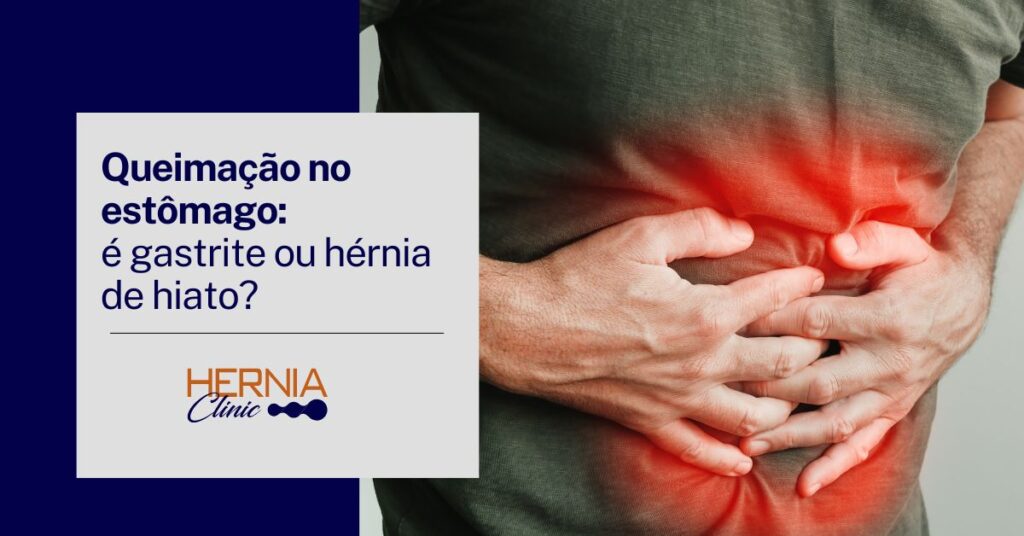 Pessoa com as mãos sobre o abdômen, demonstrando dor intensa na região estomacal, destacada por uma área vermelha que simboliza inflamação ou desconforto.