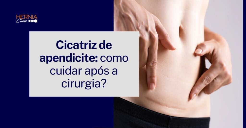 Pessoa aponta para uma cicatriz cirúrgica na região inferior do abdômen, próxima à linha da roupa, sugerindo recuperação pós-cirurgia.