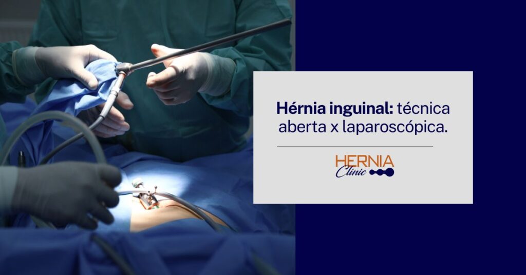 Imagem de cirurgia laparoscópica em andamento, com médicos manipulando instrumentos e paciente coberto por campo cirúrgico azul.