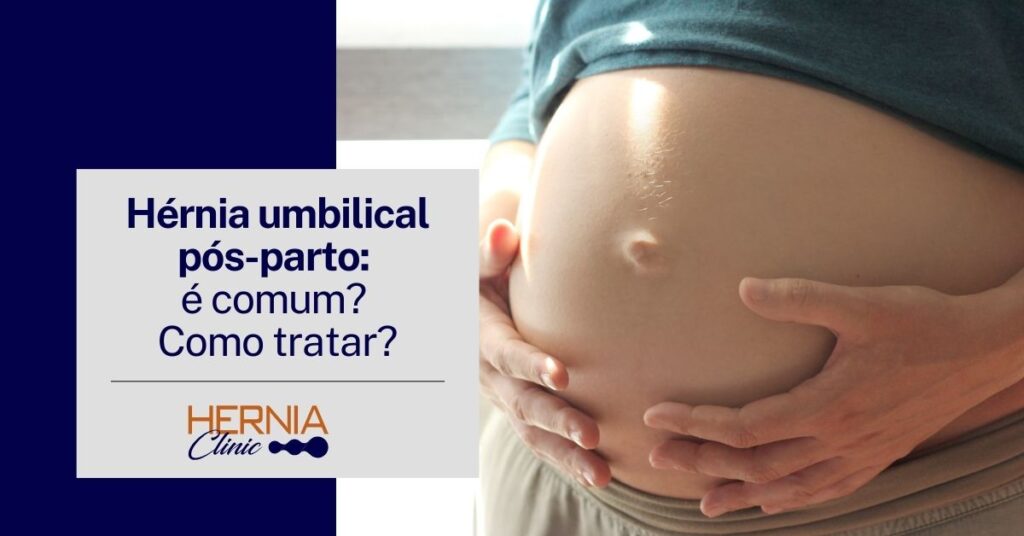 Hérnia umbilical pós-parto: é comum? Como tratar? 1 Mulher grávida segura a barriga com as duas mãos, destacando o umbigo projetado, sugerindo uma possível hérnia umbilical pós-gestação.