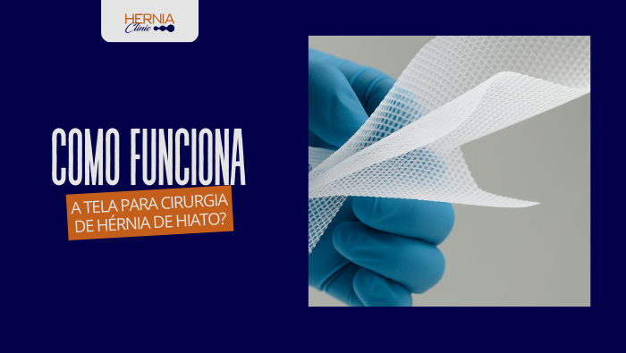 Mão com luva azul segurando tela cirúrgica branca usada em procedimentos de hérnia.