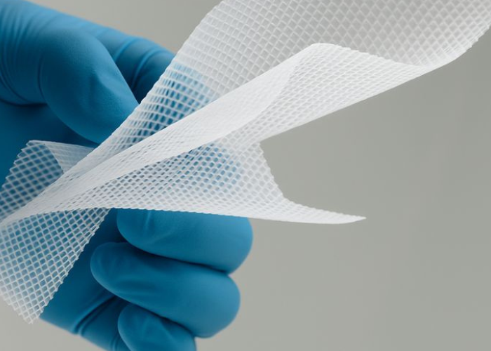 Mão com luva azul segurando tela cirúrgica branca usada em procedimentos de hérnia.