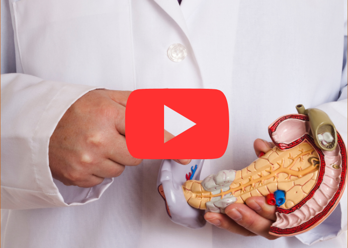 Médico segurando modelo anatômico do pâncreas, apontando para estruturas internas, representando explicação sobre cistos pancreáticos.