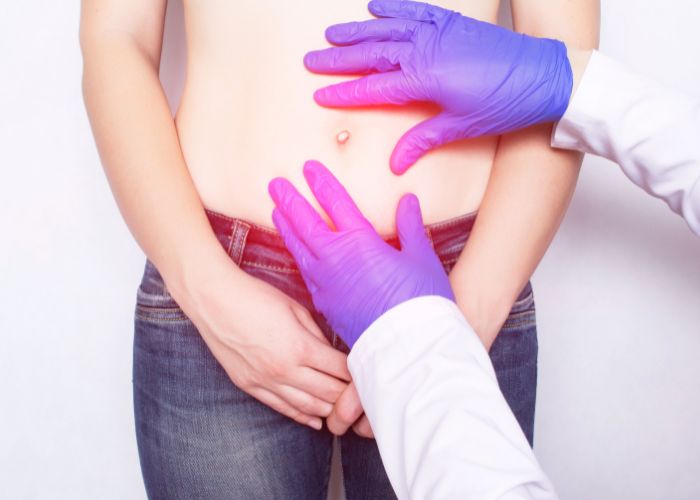 Médico examinando a região abdominal de um paciente com possível hérnia umbilical, destacada por uma área avermelhada ao redor do umbigo.