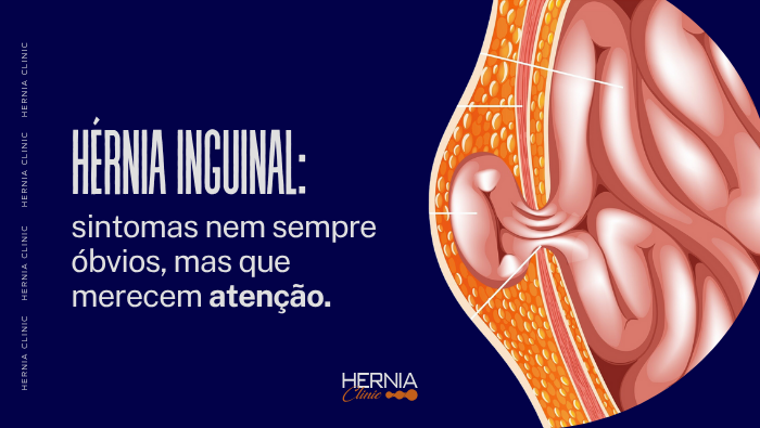 Ilustração médica mostrando uma hérnia inguinal, com parte do intestino protrudindo através da parede abdominal e destacada por camadas anatômicas.