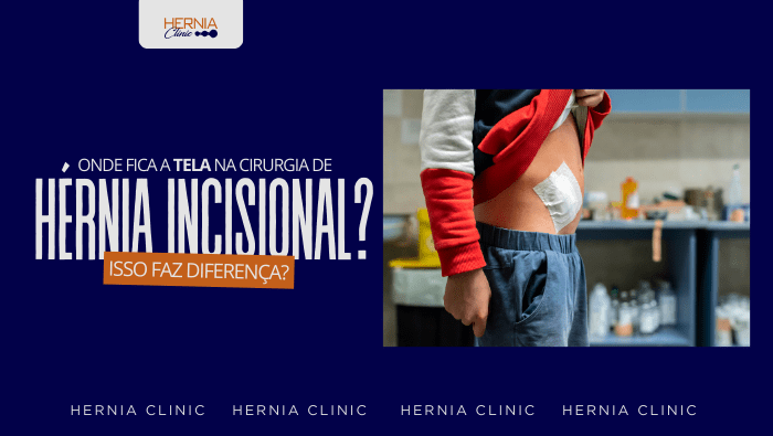 Onde fica a tela na cirurgia de hérnia incisional? Isso faz diferença? 1 Pessoa levanta a camiseta mostrando curativo no abdômen, indicando pós-operatório em ambiente clínico.