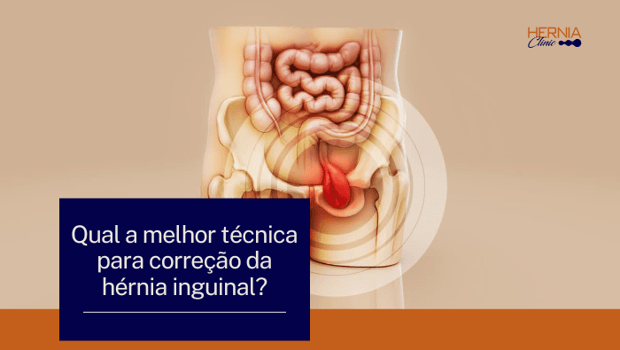 Ilustração do sistema digestivo e região pélvica com destaque para área anal, representando desconforto ou condição intestinal.