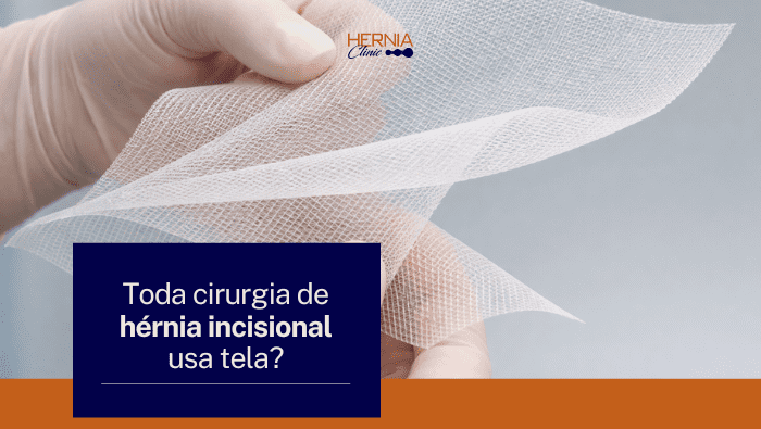 Toda cirurgia de hérnia incisional usa tela? 1 Mãos com luvas segurando uma tela cirúrgica de malha utilizada em procedimentos médicos para reforço de tecidos.