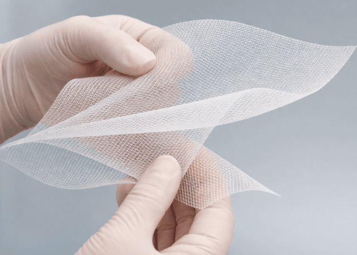 Mãos com luvas segurando uma tela cirúrgica de malha utilizada em procedimentos médicos para reforço de tecidos.
