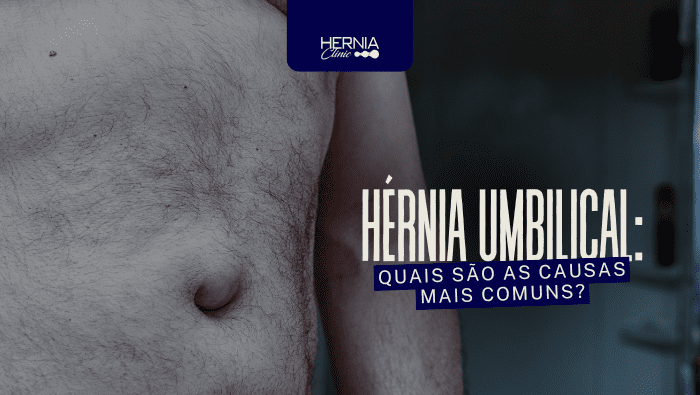 Abdômen masculino com saliência na região do umbigo, indicando possível hérnia umbilical.