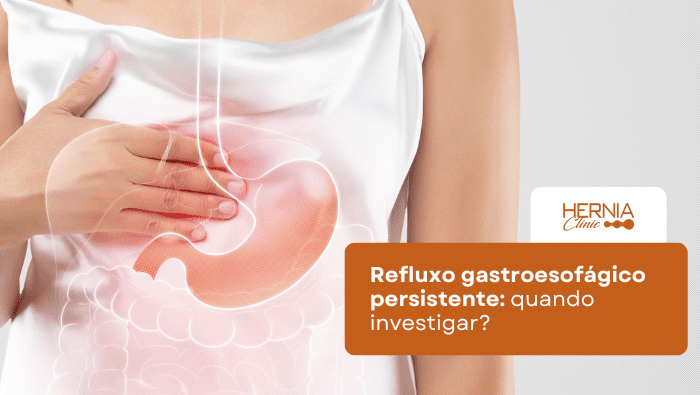 Refluxo gastroesofágico persistente: quando investigar? 1 Pessoa segura a região do estômago com ilustração sobreposta do sistema digestivo, indicando dor ou refluxo.