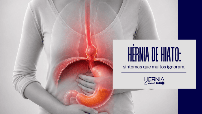 Hérnia de hiato: sintomas que muitos ignoram 1 Ilustração do sistema digestivo sobreposta ao tronco de uma pessoa, com destaque em vermelho para o esôfago, estômago e região do hiato, enquanto a pessoa mantém as mãos sobre o abdômen.
