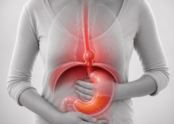 Ilustração do sistema digestivo sobreposta ao tronco de uma pessoa, com destaque em vermelho para o esôfago, estômago e região do hiato, enquanto a pessoa mantém as mãos sobre o abdômen.