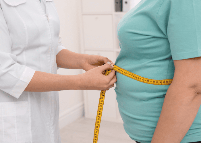 Profissional de saúde medindo a circunferência abdominal de paciente com fita métrica, representando obesidade e avaliação de hérnia abdominal.