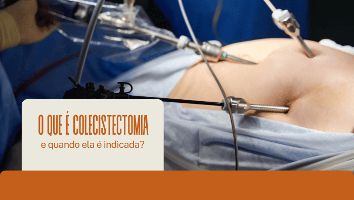 Equipe médica realizando cirurgia laparoscópica com instrumentos minimamente invasivos, representando colecistectomia e tratamento da vesícula biliar.