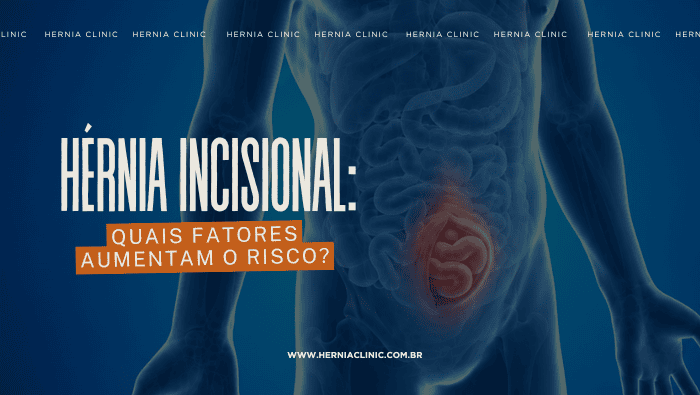 Hérnia incisional: quais fatores aumentam o risco? 1 Arte sobre hérnia incisional e fatores de risco