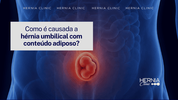 Arte sobre hérnia umbilical com conteúdo adiposo