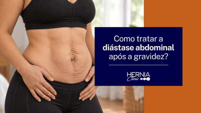 Como tratar a diástase abdominal após a gravidez? 1 Arte sobre tratamento da diástase abdominal após a gravidez