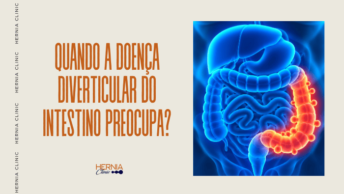 Arte sobre doença diverticular do intestino e sinais de preocupação