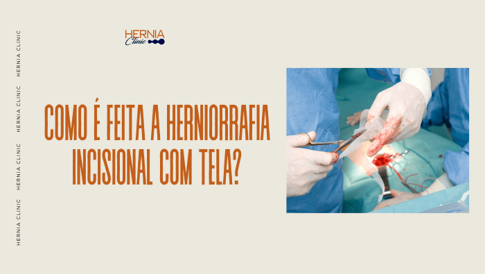 Como é feita a herniorrafia incisional com tela? 1 Arte sobre herniorrafia incisional com tela e correção cirúrgica de hérnia